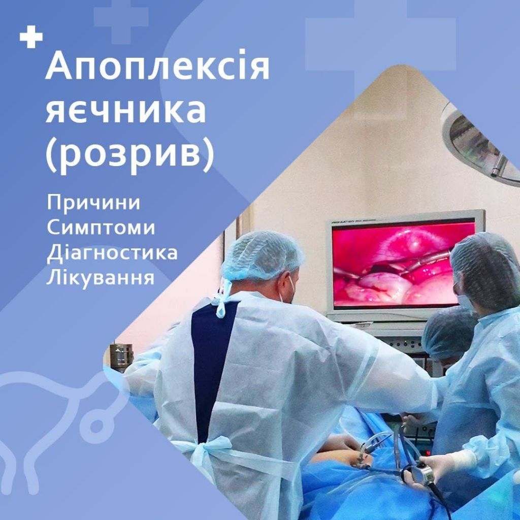 Апоплексія яєчника (розрив). Причини, симптоми, діагностика, лікування Апоплексія яєчника (розрив). Причини, симптоми, діагностика, лікування