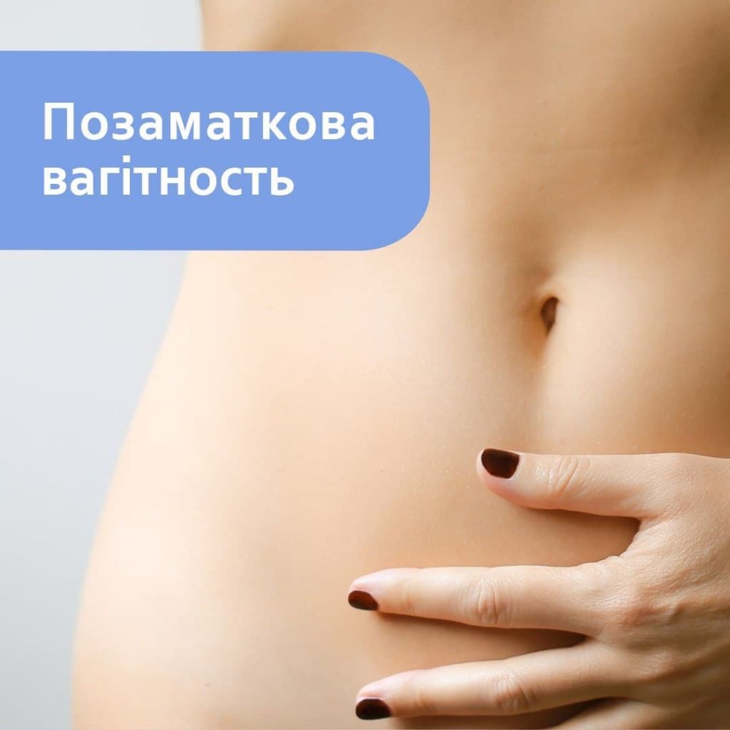 Позаматкова вагітність, класифікація та випадки Позаматкова вагітність, класифікація та випадки