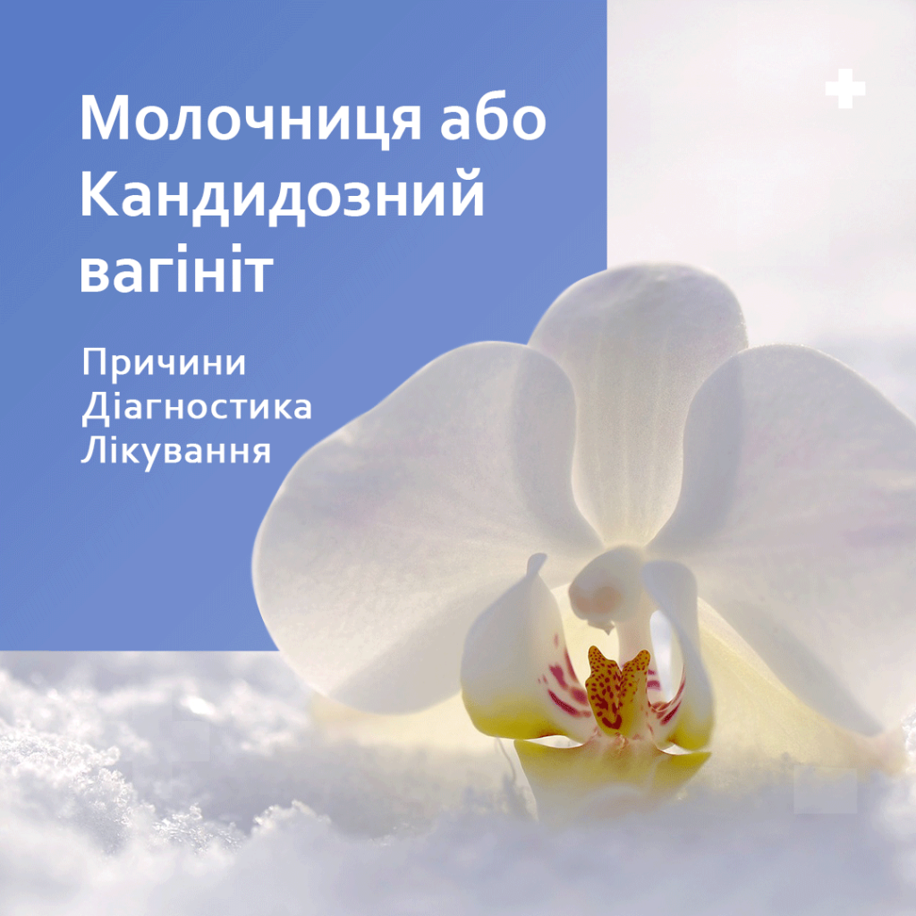 Молочниця (кандидозній вігініт). Причини, діагностика, лікування Молочниця (кандидозній вігініт). Причини, діагностика, лікування