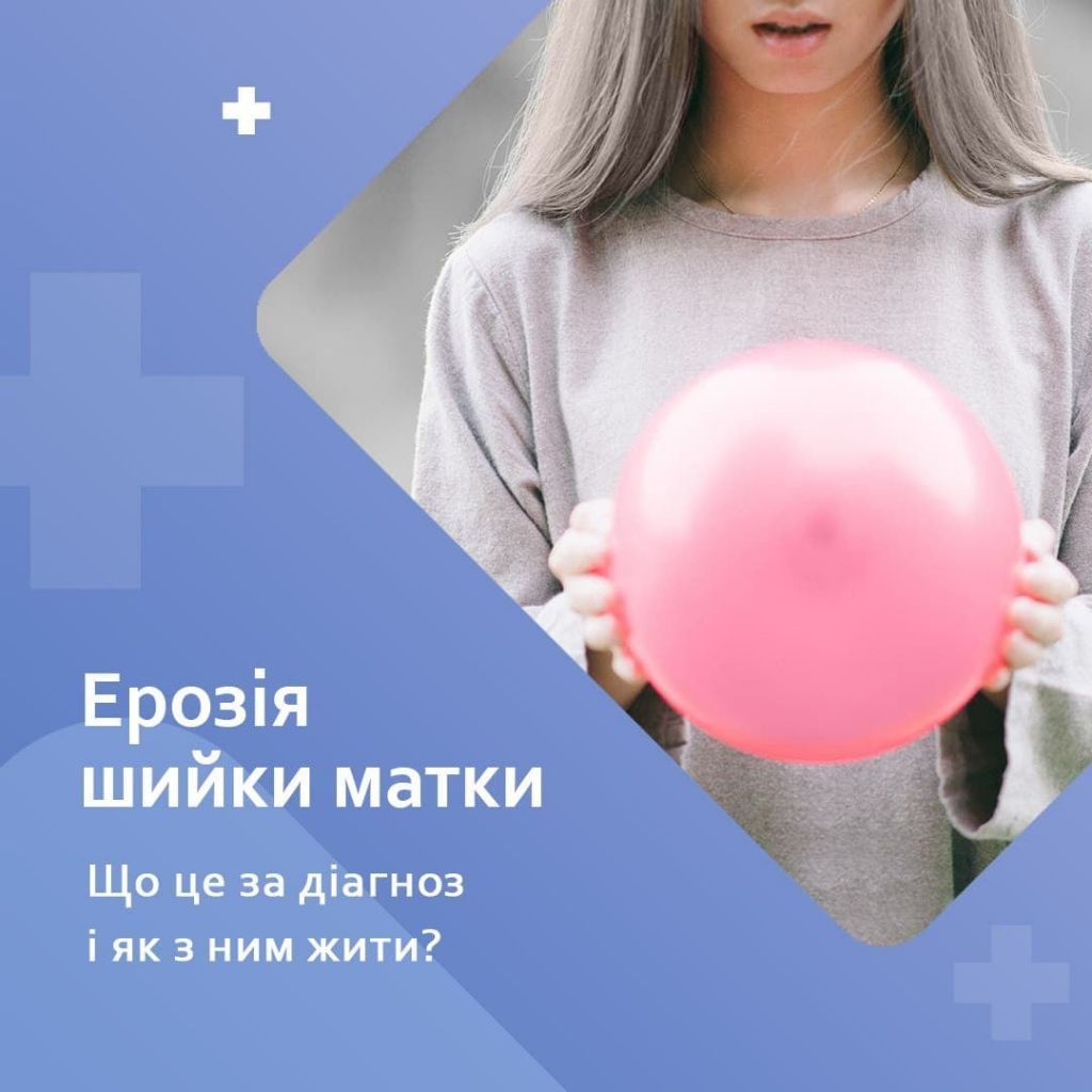 Єрозія шийки матки. Що це? Види, чому виникає, діагностика, лікування Єрозія шийки матки. Що це? Види, чому виникає, діагностика, лікування