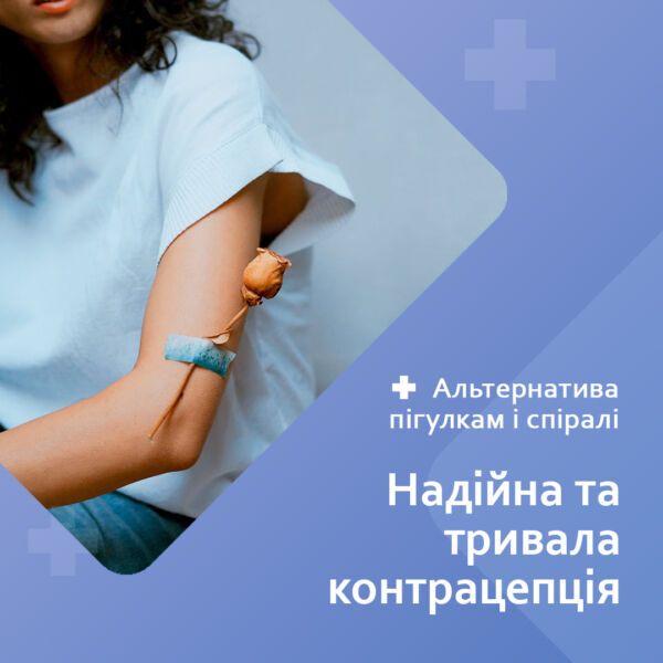 Підшкірні протизаплідні імплантати. Альтернатива пігулкам, спіралі? Підшкірні протизаплідні імплантати. Альтернатива пігулкам, спіралі?
